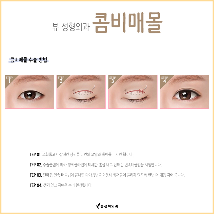 VIEW 콤비매몰로 자연스럽고 더 또렷하게 관련 이미지 2