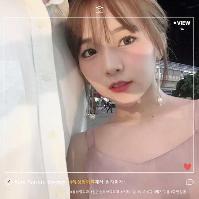팔자주름 더이상 고민하지 마세요! 관련 이미지 2