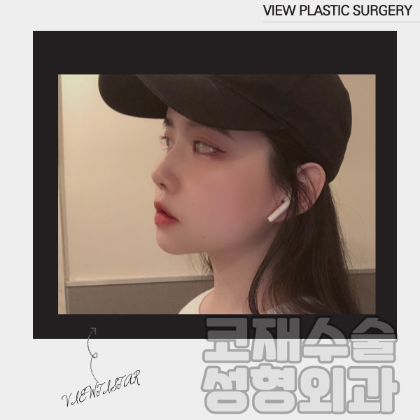코재수술성형외과 찾고있다면 뷰성형외과로 관련 이미지 12