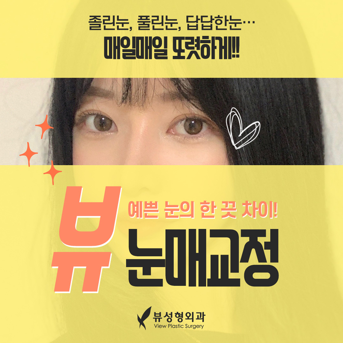나만의 눈성형을 위한 수술방법 알아보기 관련 이미지 7