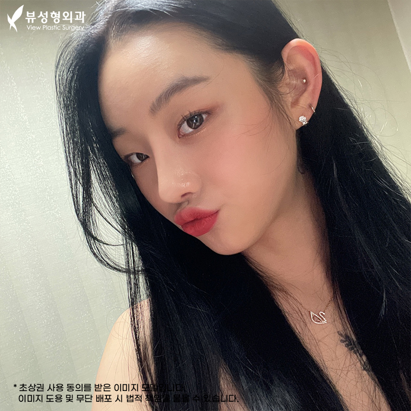 코성형잘하는곳 유형별로 올바르게 관련 이미지 6