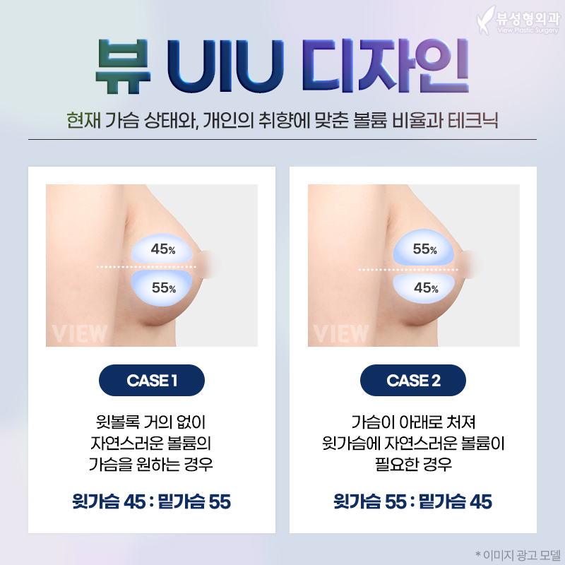 가슴성형 모양과 촉감은 기본, 안전은 필수! 관련 이미지 3