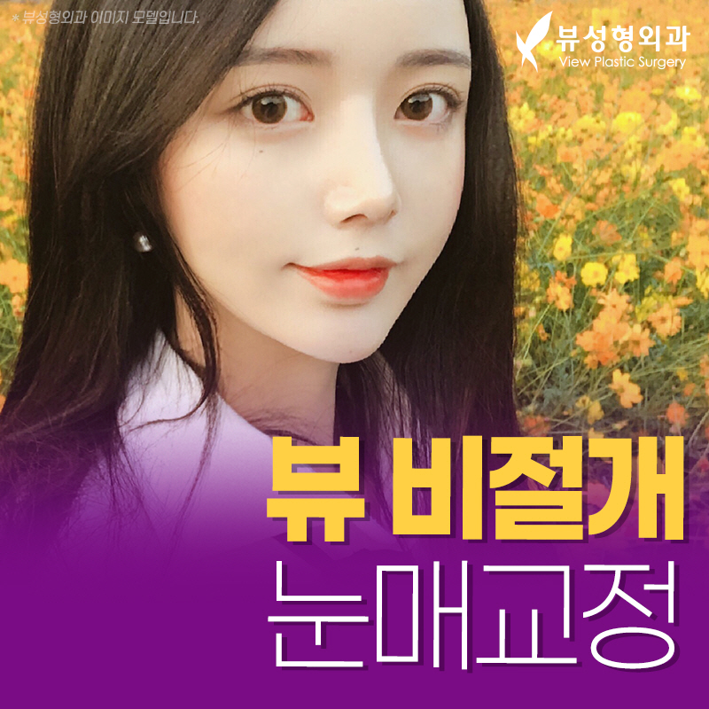 쌍꺼풀수술비용, 목적에 맞춰서 관련 이미지 5