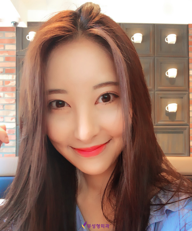 윤곽성형으로 자신감을 얻다! 관련 이미지 3