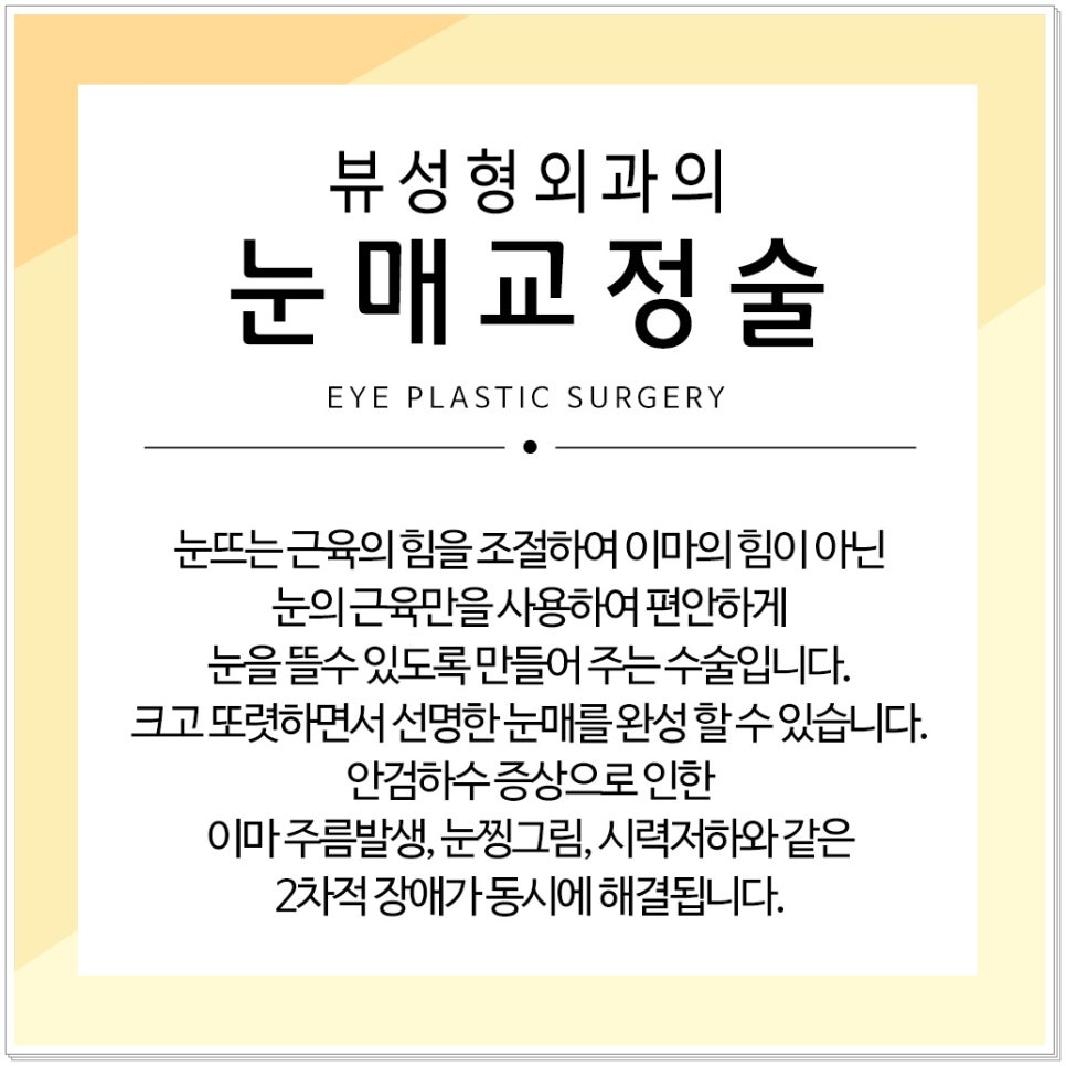 졸린눈, 뷰성형외과 눈매교정으로 또렷하게! 관련 이미지 4