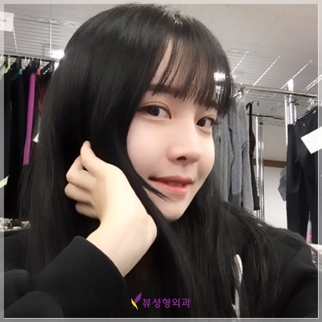 강남코재수술 하면 뷰성형외과지★ 관련 이미지 1