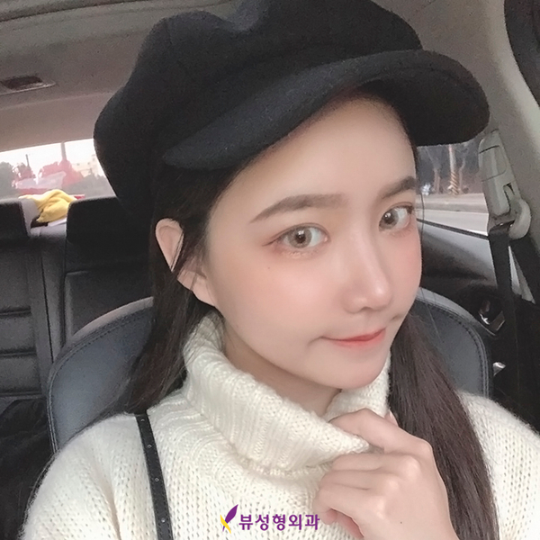 쌍꺼풀수술잘하는병원 뷰성형외과, 다 이유가 있찌🧡 관련 이미지 8