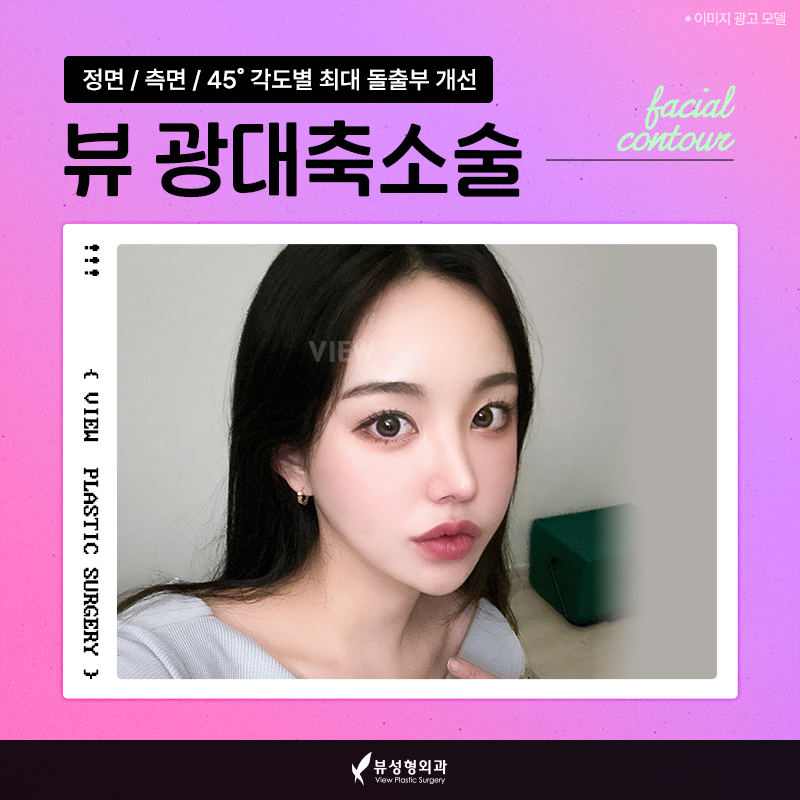 얼굴형의 밸런스를 맞춰주는 안면윤곽수술 관련 이미지 5