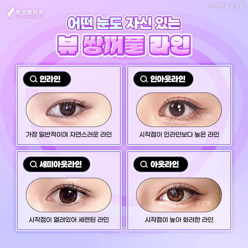 내게 맞는 눈성형 알아보기 관련 이미지 8