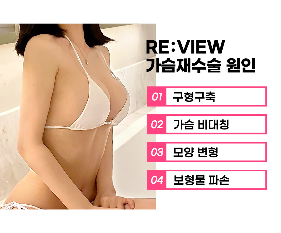 두 번은 없을 가슴 재수술, 가슴 재수술 잘하는 곳에서 관련 이미지 3