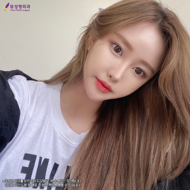 안면윤곽잘하는곳 계란형 얼굴로 관련 이미지 1