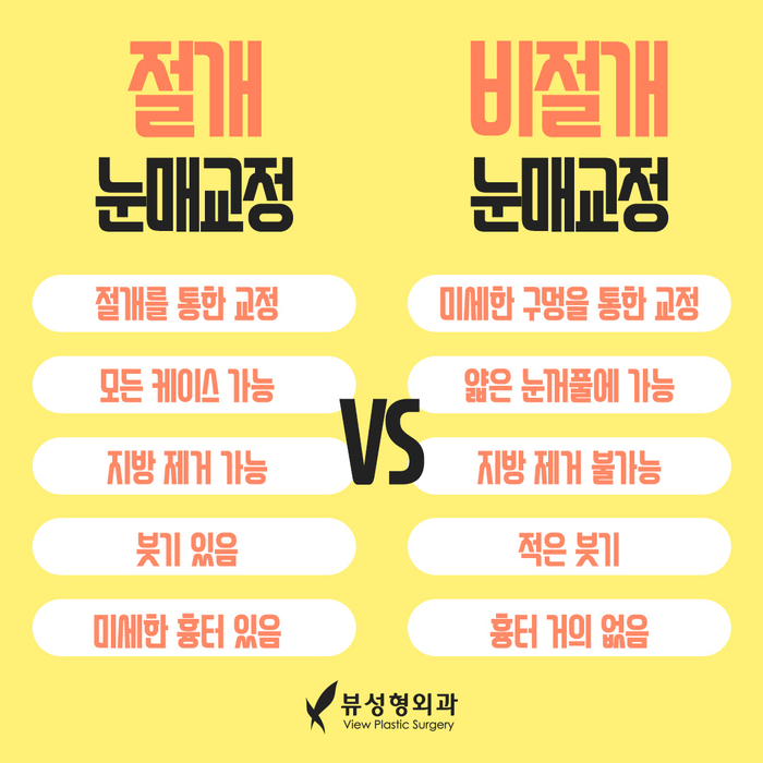 나만의 눈성형을 위한 수술방법 알아보기 관련 이미지 8