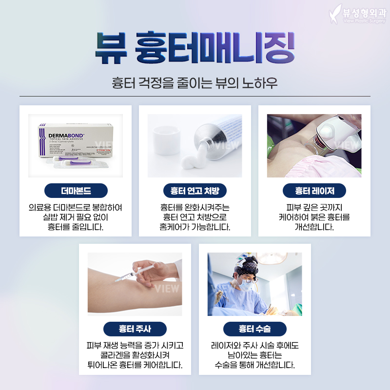 가슴성형 모양과 촉감은 기본, 안전은 필수! 관련 이미지 8