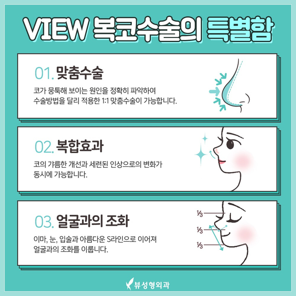 뭉툭한 코끝, 뷰성형외과 복코수술로 슬림하게~! 관련 이미지 8
