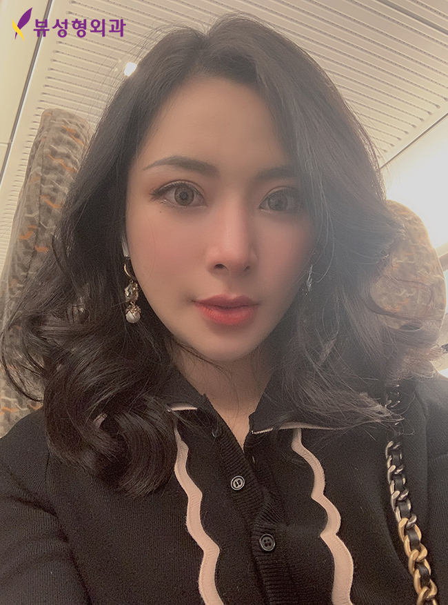 젊음의비결! 부분거상술 상안검/하안검 선택하세요 관련 이미지 8