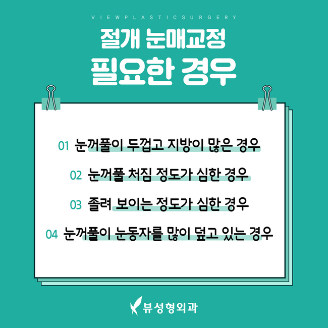 답답한 눈매 또렷해지려면? 뷰성형외과 눈매교정으로 관련 이미지 7