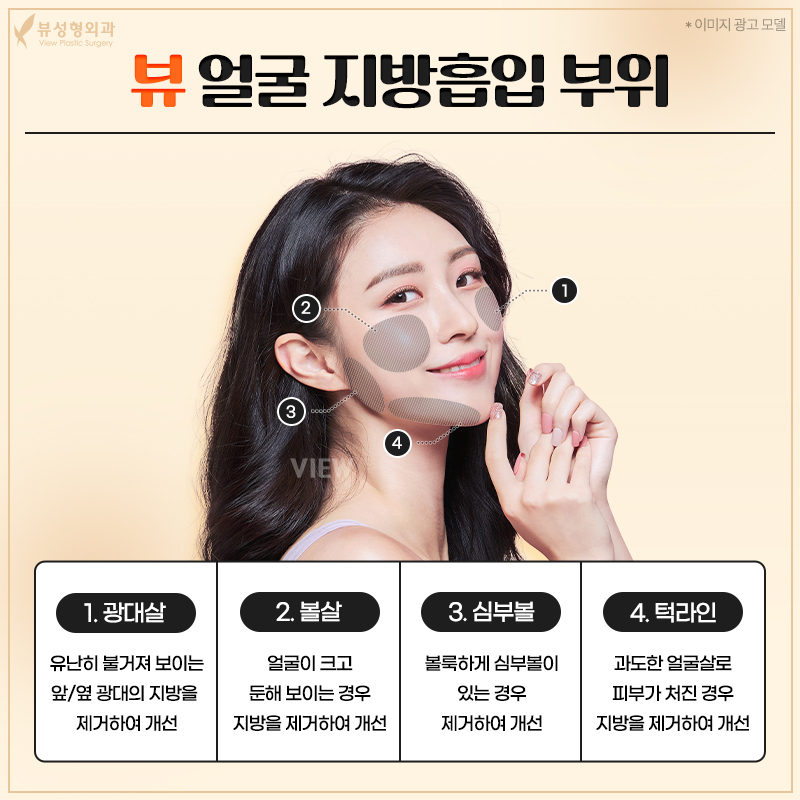 살빼도 이중턱 안없어진다면? 갈테야테야 투턱 없애러 갈테야 관련 이미지 2