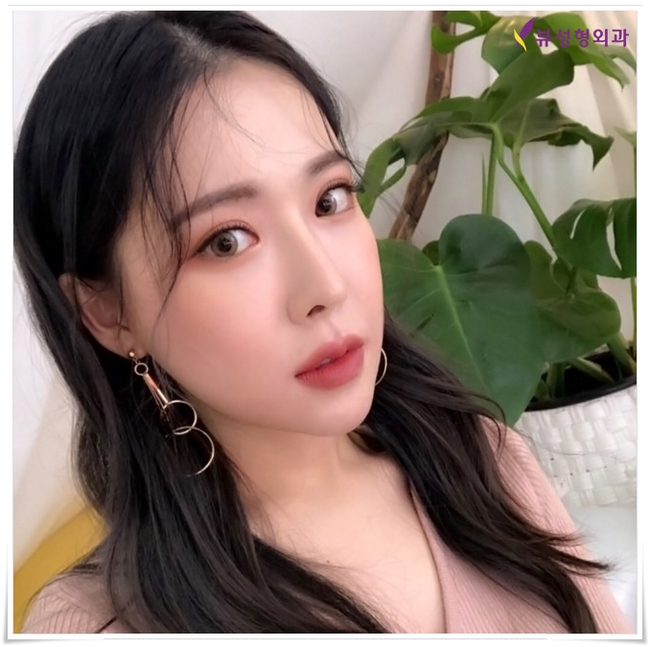 뷰성형외과 코성형종류 나에게 적합한 방법은? 관련 이미지 7