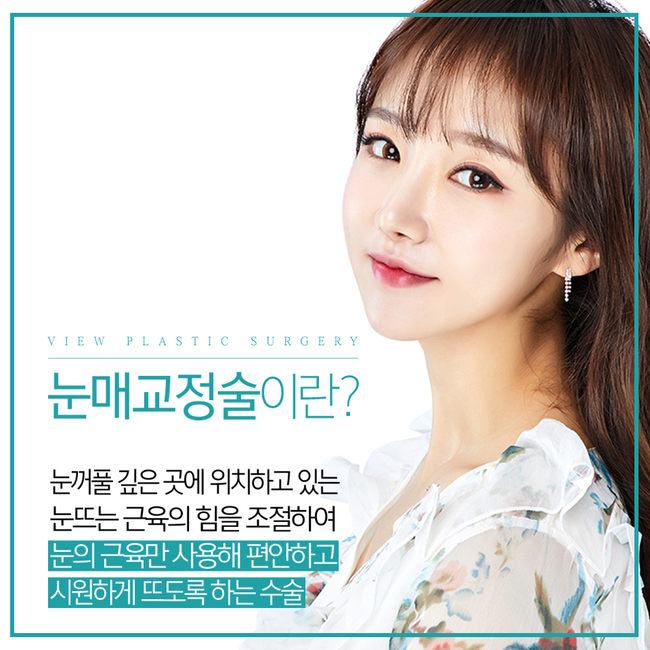 답답한 눈매 또렷해지려면? 뷰성형외과 눈매교정으로 관련 이미지 3