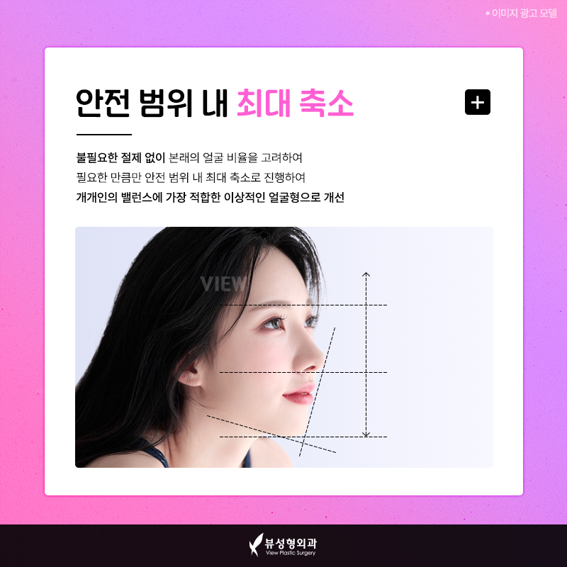얼굴형의 밸런스를 맞춰주는 안면윤곽수술 관련 이미지 2
