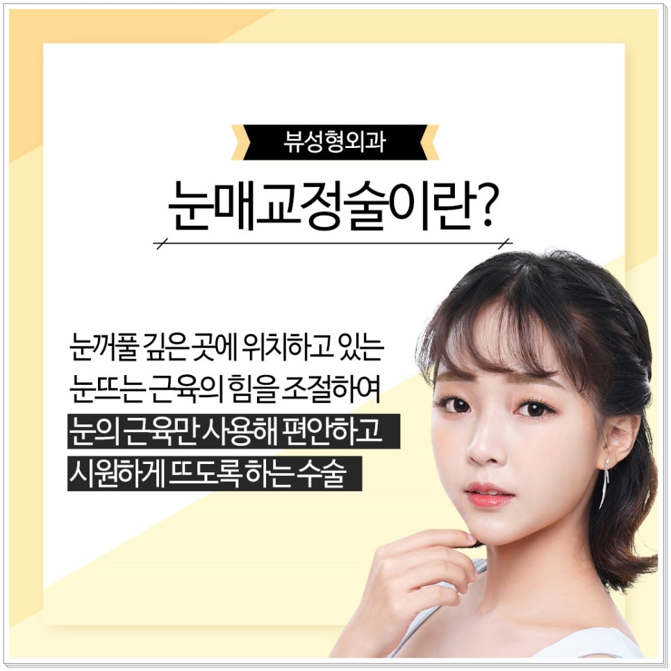 졸린눈, 뷰성형외과 눈매교정으로 또렷하게! 관련 이미지 3