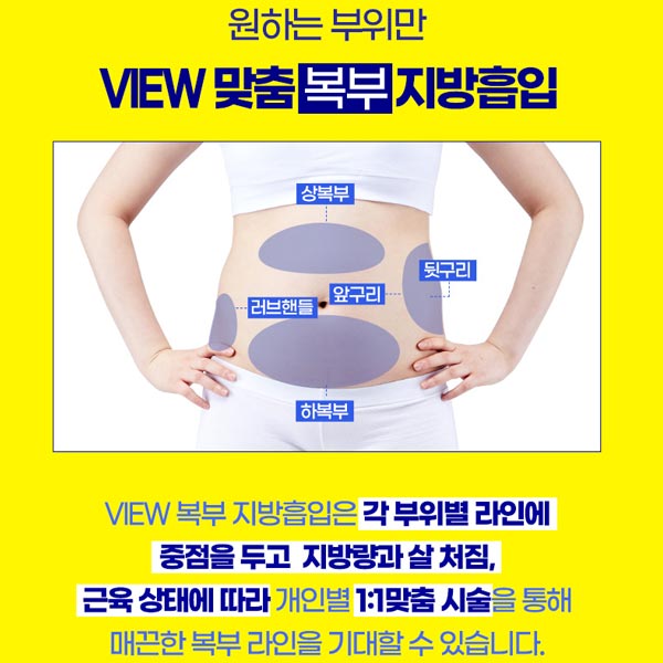 지방흡입후관리 왜 중요할까? 관련 이미지 4