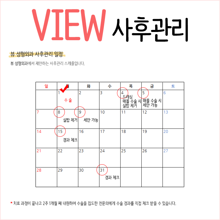 뷰 눈성형 사후관리는 어떨까? 관련 이미지 4