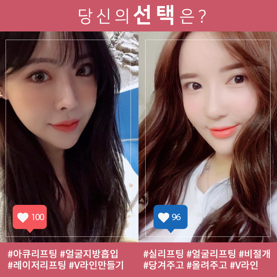 얼굴뼈성형 후 리프팅! 볼처짐 걱정말아요 관련 이미지 7