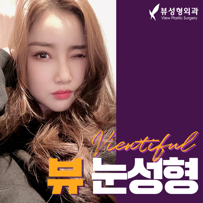 내게 맞는 눈성형을 위한 수술방법 관련 이미지 6