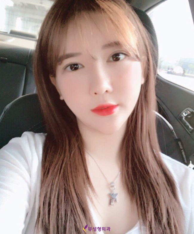 윤곽성형으로 자신감을 얻다! 관련 이미지 4