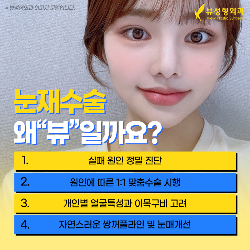 눈재수술유명한곳, 뷰성형외과 관련 이미지 2