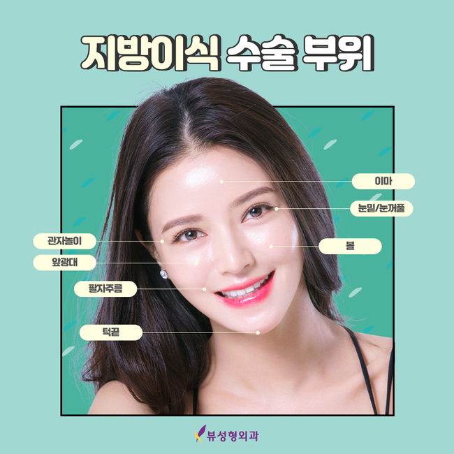 이마지방이식 옆모습이 아주 예쁘죠? 관련 이미지 5