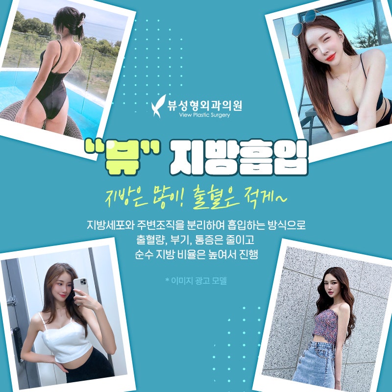 뷰성형외과가 알려주는 복부지방흡입 A to Z 관련 이미지 5