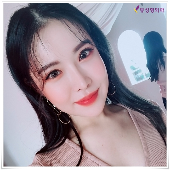 뷰성형외과 코성형종류 나에게 적합한 방법은? 관련 이미지 9