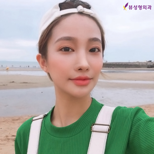 안면윤곽성형외과 보다 나아진 인상을 관련 이미지 9