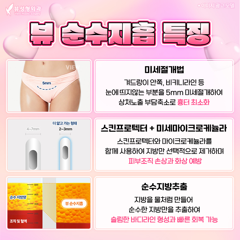 단기간내 눈에 띄는 지방 감량 방법, 지방흡입 관련 이미지 2