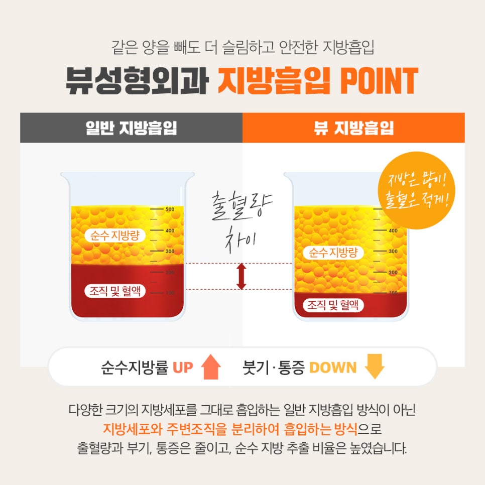 전신지방흡입, 라인과 탄력 그리고 안전까지! 관련 이미지 4