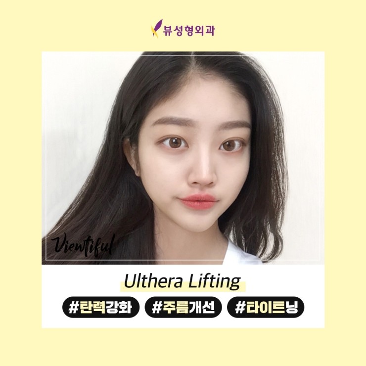 [알림] ★☆ 울쎄라이벤트 놓치지 마세요! (~20.04.30까지) ★☆ 관련 이미지 4