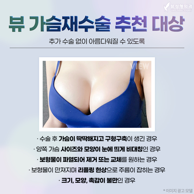 가슴재수술 전 알아두면 좋은 것들! 관련 이미지 3