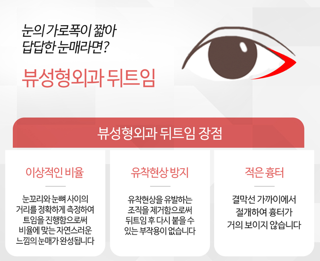 뷰성형외과 트임성형수술로 예쁨 충전 완료&hearts; 관련 이미지 6