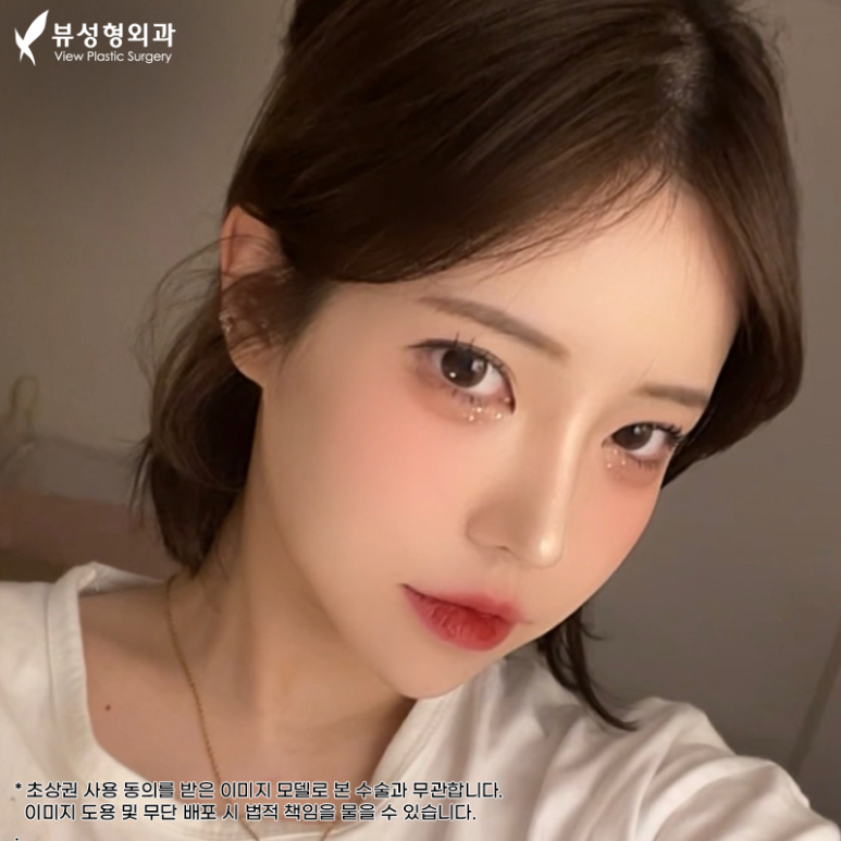 예쁘고 건강한 코, 비염치료과 코성형을 동시에 관련 이미지 2