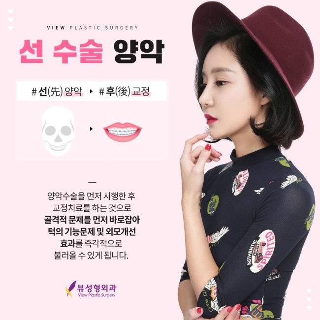 예뻐지는 수술? 양악수술의 올바른 정보 관련 이미지 6