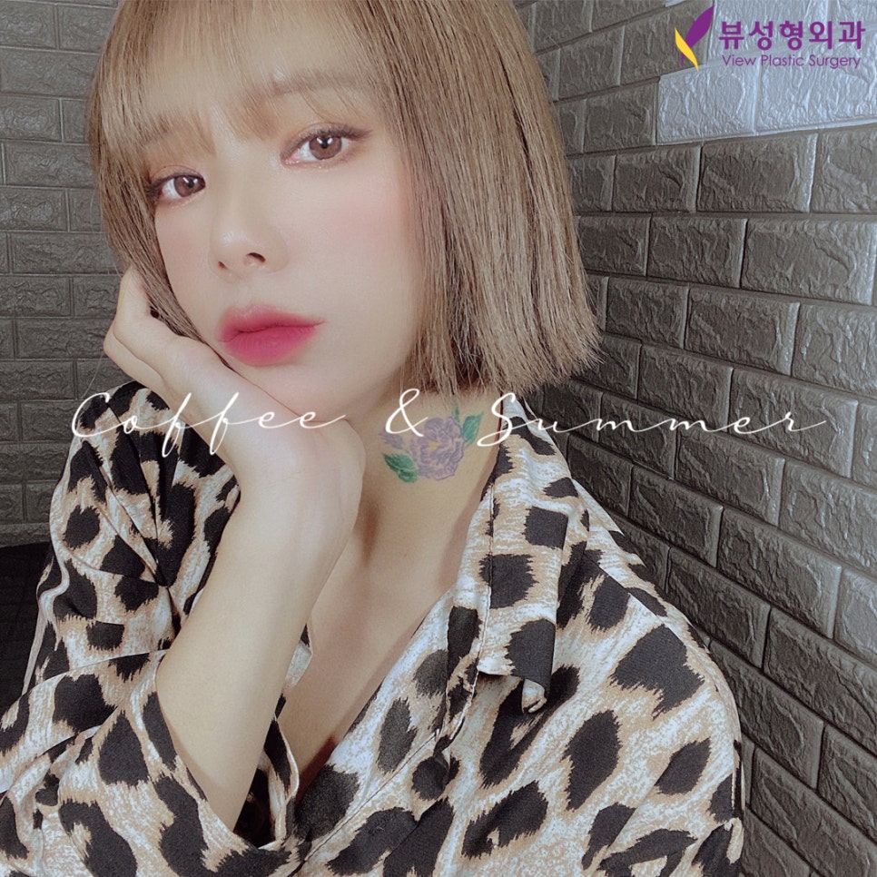 쌍꺼풀 절개법과 매몰법, 어떤 방법이 더 좋을까? 관련 이미지 1