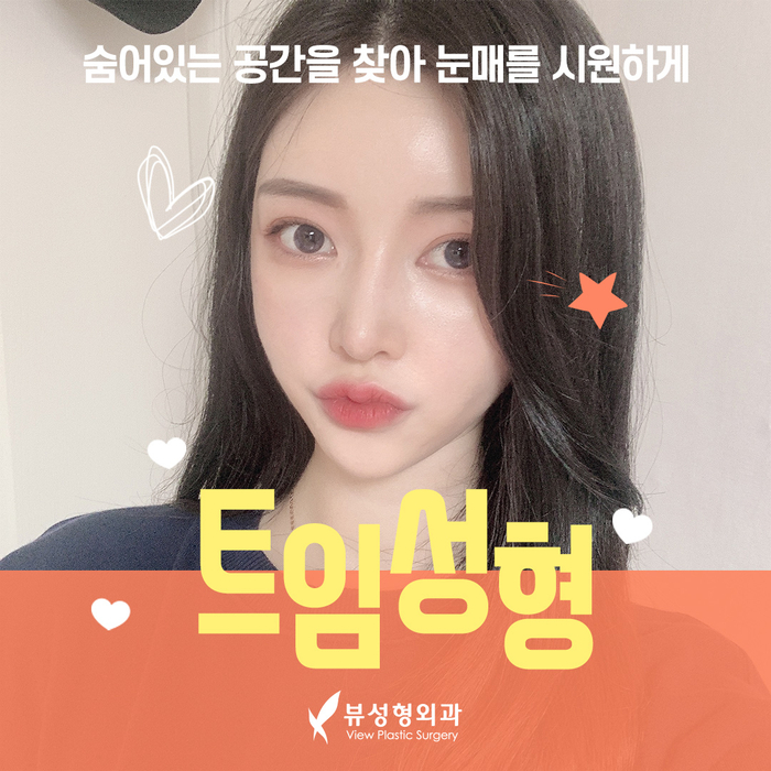 나만의 눈성형을 위한 수술방법 알아보기 관련 이미지 9