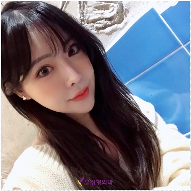 더 이상의 실패 없는, 뷰성형외과 코재수술 관련 이미지 7