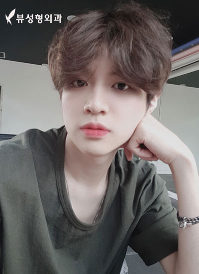 남자안면윤곽 새로운 변화를 원한다면 관련 이미지 9