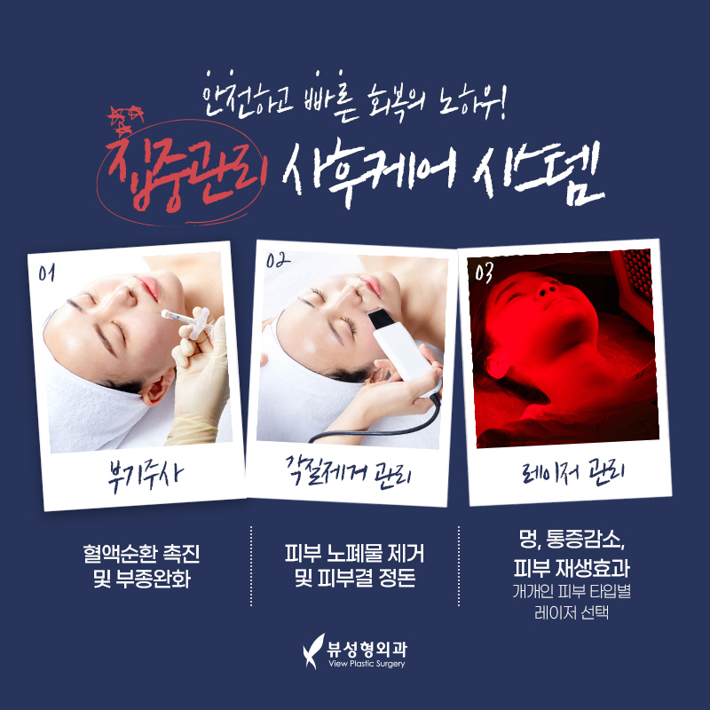 얼굴형의 밸런스를 맞춰주는 안면윤곽수술 관련 이미지 14