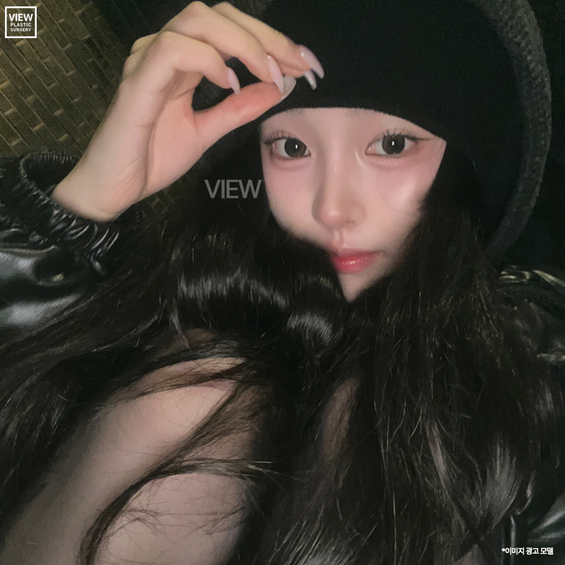 코성형 전, 콧구멍을 봐야 하는 이유? 관련 이미지 3