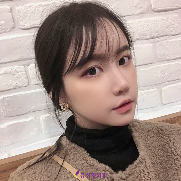 쌍꺼풀수술잘하는병원 뷰성형외과, 다 이유가 있찌🧡 관련 이미지 6