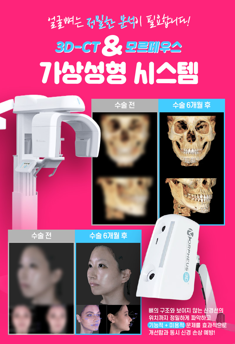 안면윤곽가격 이상적인 얼굴형으로 관련 이미지 3